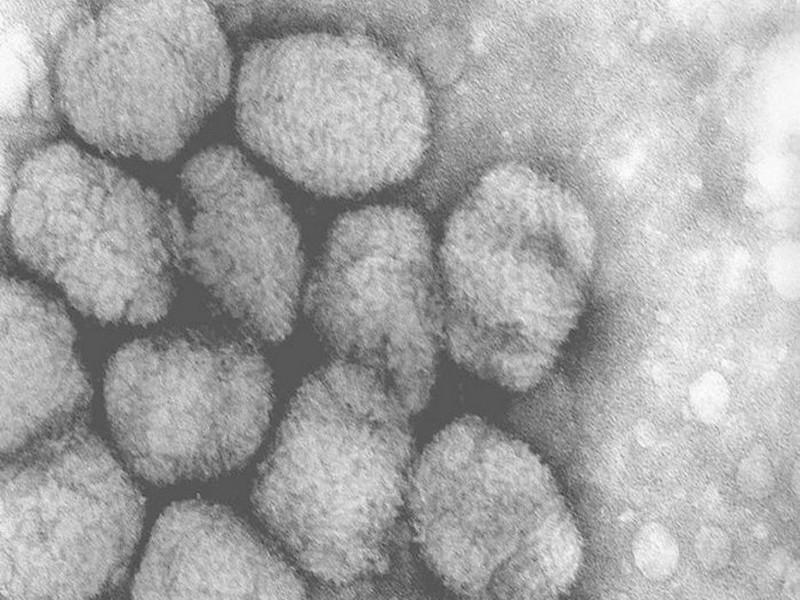 Russie : explosion dans un laboratoire renfermant la variole et Ebola