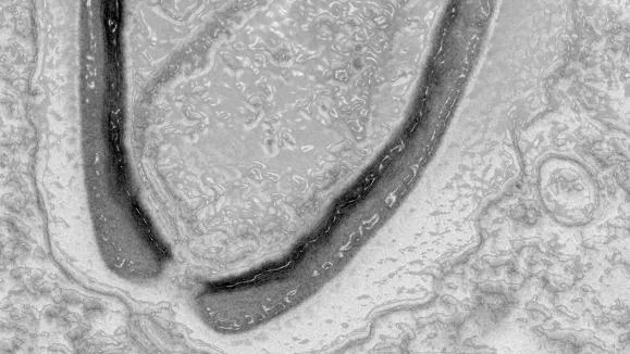 Le billet sciences. Les virus préhistoriques inquiètent des chercheurs