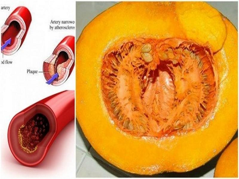 Dites adieu au cholestérol, à la glycémie, aux lipides et au triglycéride !